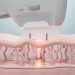 Close up Ultherapy or HIFU treatment shot laser to SMAS to lift and tighten skin, Blue science background. 3D rendering.